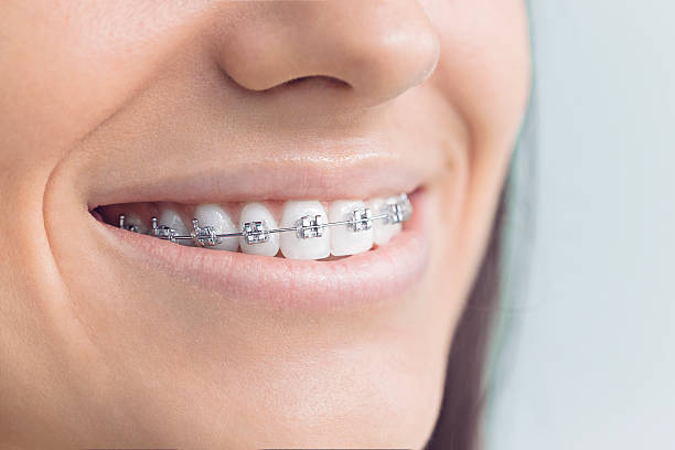 Best Invisalign and Clear Aligners  in Salado, TX